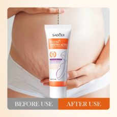 8 Pieces SADOER Oatmeal Stretch Mark Cream Mild and non-irritating wrinkle body lotion wholesale - Image 5