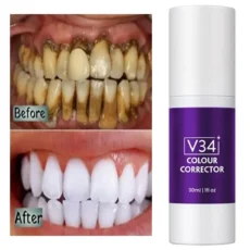 Teeth Whitening Kit