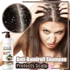 SADOER 500ml Nourishing Coconut Oil Dandruff Removal Shampoo Professional - Image 3