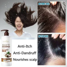 SADOER 500ml Nourishing Coconut Oil Dandruff Removal Shampoo Professional - Image 4