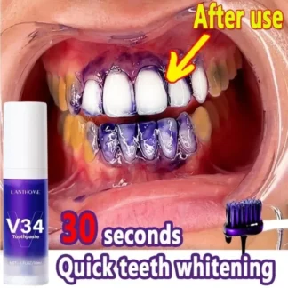 purple teeth whitening