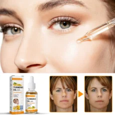 Whitening Freckles Serum Oil Turmeric Remove Dark Spots Melasma Lighten Melanin Anti-aging Improve Dull Face Brighten Skin Care - Image 2