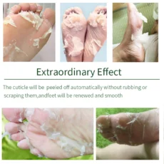 10 Pairs Lavender & VC Foot Peeling Mask Exfoliating Heels Calluses Remove Foot Patches Dead Skin Remover Pedicure Socks Foot Care - Image 2