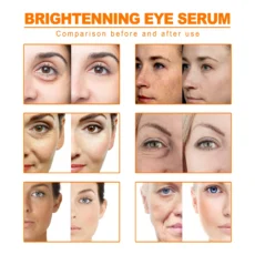 Whitening Freckles Serum Oil Turmeric Remove Dark Spots Melasma Lighten Melanin Anti-aging Improve Dull Face Brighten Skin Care - Image 3