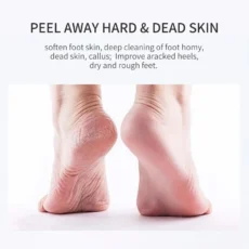 10 Pairs Lavender & VC Foot Peeling Mask Exfoliating Heels Calluses Remove Foot Patches Dead Skin Remover Pedicure Socks Foot Care - Image 6