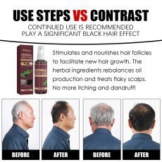 South Moon Herbal White to Black Hair Lotion Polygonum multiflorum Herbal essence Moisturizes and protects white hair and turns black hair - Image 3